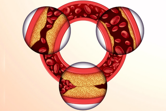 Damar Hastalıkları (2)